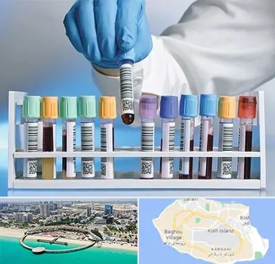 آزمایشگاه شبانه روزی در کیش