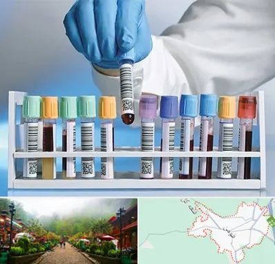 آزمایشگاه شبانه روزی در فومن