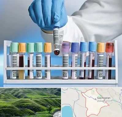آزمایشگاه شبانه روزی در گچساران