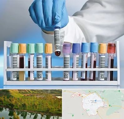 آزمایشگاه شبانه روزی در بهبهان