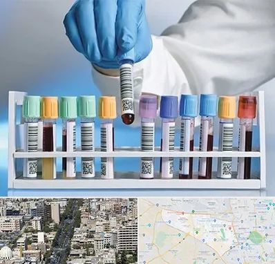 آزمایشگاه شبانه روزی در منطقه 18 تهران