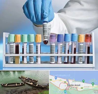 آزمایشگاه شبانه روزی در بندر انزلی