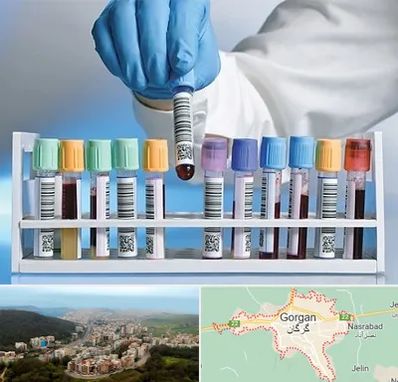 آزمایشگاه شبانه روزی در گرگان