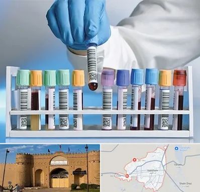 آزمایشگاه شبانه روزی در ایرانشهر