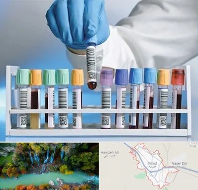 آزمایشگاه شبانه روزی در دورود