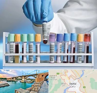 آزمایشگاه شبانه روزی در دزفول