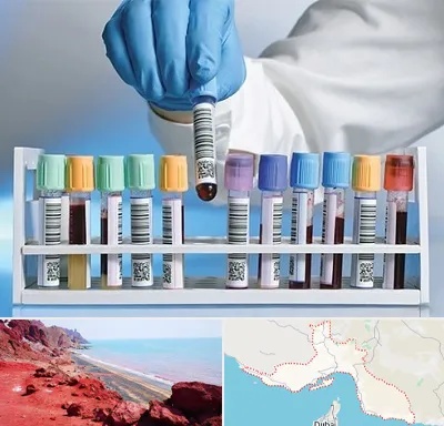 آزمایشگاه شبانه روزی در هرمزگان