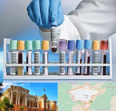 آزمایشگاه شبانه روزی در خوی