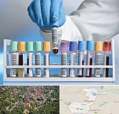 آزمایشگاه شبانه روزی در دماوند