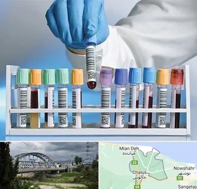 آزمایشگاه شبانه روزی در چالوس