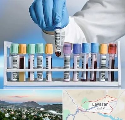 آزمایشگاه شبانه روزی در لواسان