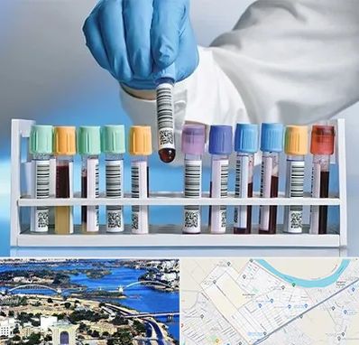 آزمایشگاه شبانه روزی در کوروش اهواز