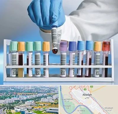 آزمایشگاه شبانه روزی در آبادان