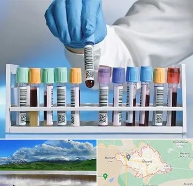 آزمایشگاه شبانه روزی در مرند