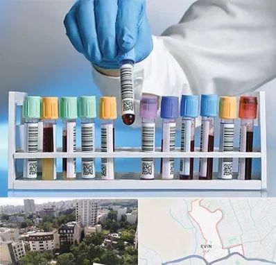 آزمایشگاه شبانه روزی در اوین