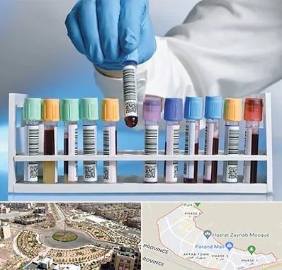 آزمایشگاه شبانه روزی در پرند