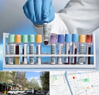 آزمایشگاه شبانه روزی در کوی فیروز تبریز