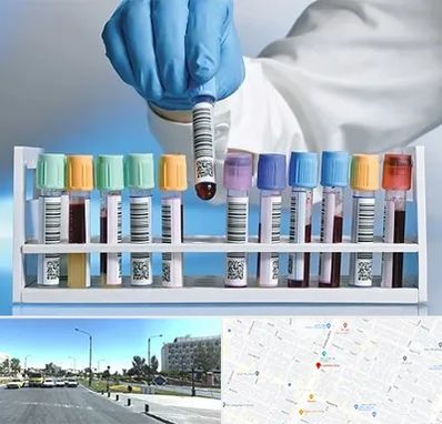 آزمایشگاه شبانه روزی در بلوار کلاهدوز مشهد