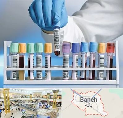 آزمایشگاه شبانه روزی در بانه