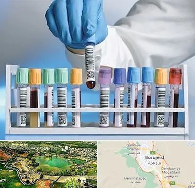 آزمایشگاه شبانه روزی در بروجرد