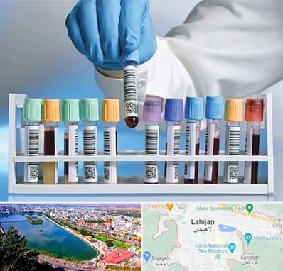 آزمایشگاه شبانه روزی در لاهیجان