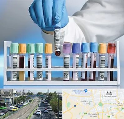 آزمایشگاه شبانه روزی در جنوب تهران