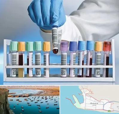 آزمایشگاه شبانه روزی در چابهار