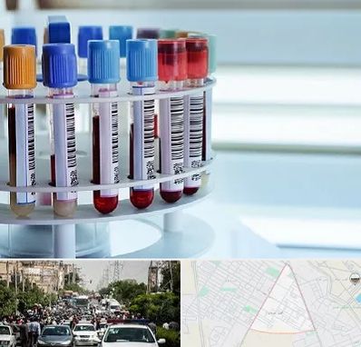 آزمایشگاه ژنتیک در سیدی مشهد