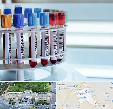 آزمایشگاه ژنتیک در نسیم شهر