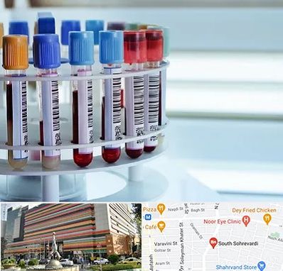 آزمایشگاه ژنتیک در سهروردی