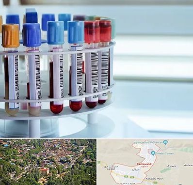 آزمایشگاه ژنتیک در دماوند