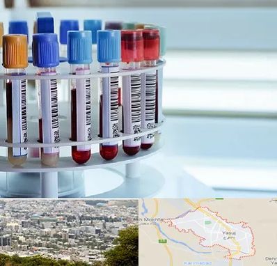 آزمایشگاه ژنتیک در یاسوج