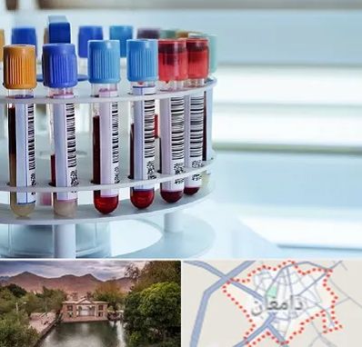 آزمایشگاه ژنتیک در دامغان