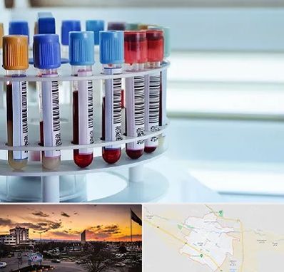 آزمایشگاه ژنتیک در قوچان