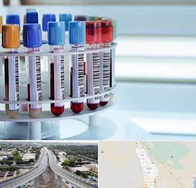 آزمایشگاه ژنتیک در اندیمشک