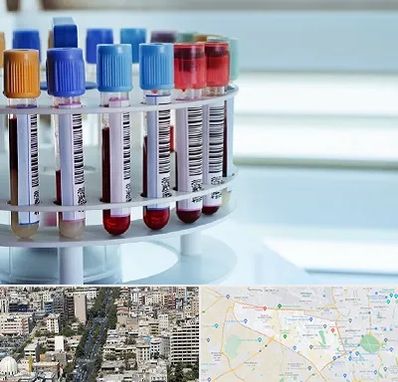 آزمایشگاه ژنتیک در منطقه 18 تهران