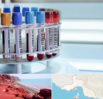آزمایشگاه ژنتیک در هرمزگان