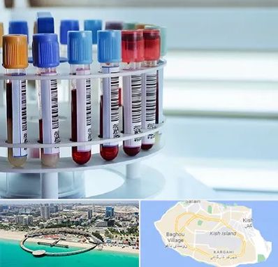 آزمایشگاه ژنتیک در کیش