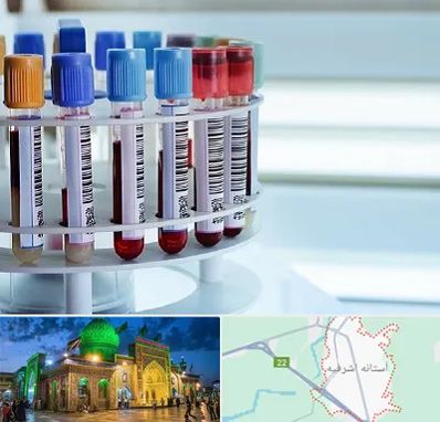 آزمایشگاه ژنتیک در آستانه اشرفیه