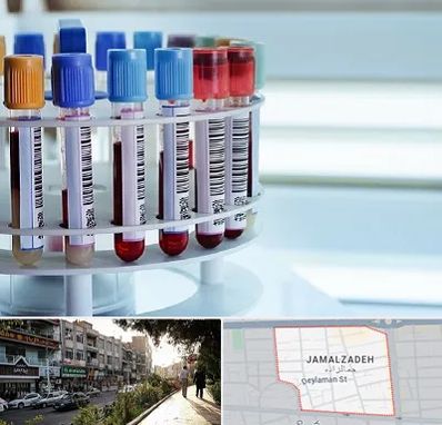 آزمایشگاه ژنتیک در خیابان جمالزاده