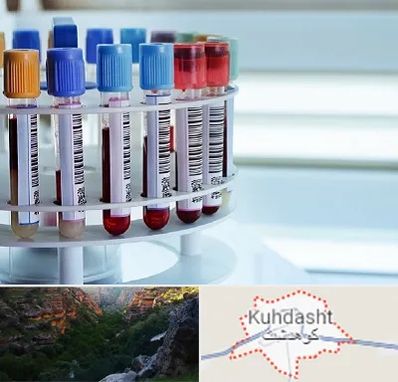 آزمایشگاه ژنتیک در کوهدشت