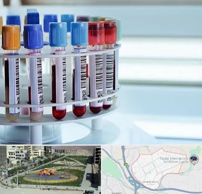 آزمایشگاه ژنتیک در مرزداران تبریز