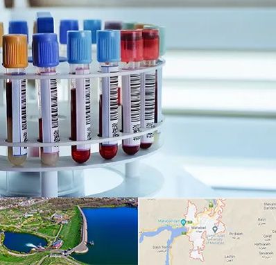 آزمایشگاه ژنتیک در مهاباد