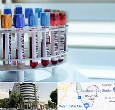 آزمایشگاه ژنتیک در قلهک