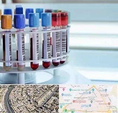 آزمایشگاه ژنتیک در شهرک غرب مشهد