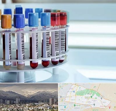 آزمایشگاه ژنتیک در منطقه 4 تهران