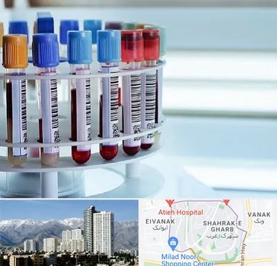 آزمایشگاه ژنتیک در شهرک غرب