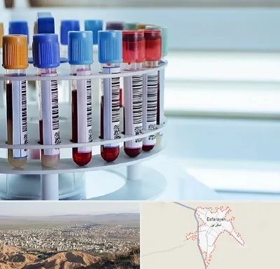 آزمایشگاه ژنتیک در اسفراین
