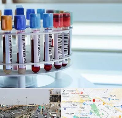 آزمایشگاه ژنتیک در بلوار توس مشهد