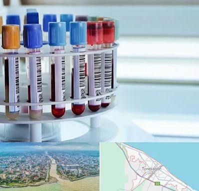 آزمایشگاه ژنتیک در تنکابن